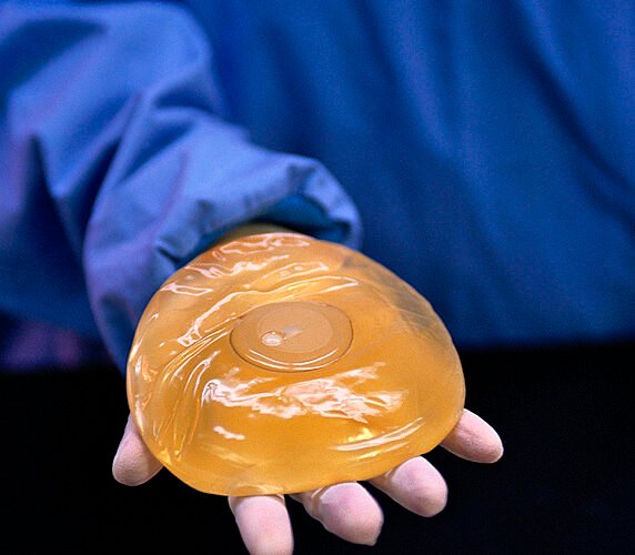 Sanidad confirma 102 casos de un raro linfoma asociado a implantes de mama