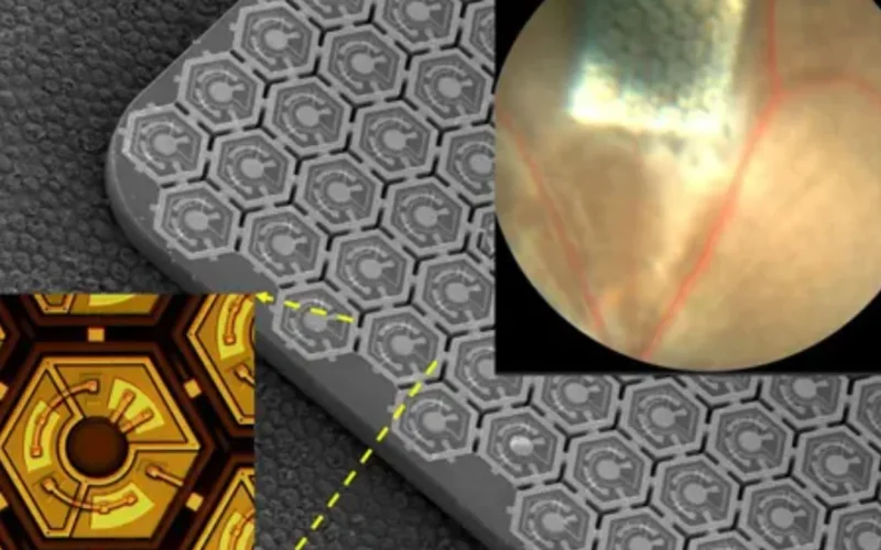 Una prótesis de retina proporciona visión artificial a ratones ciegos