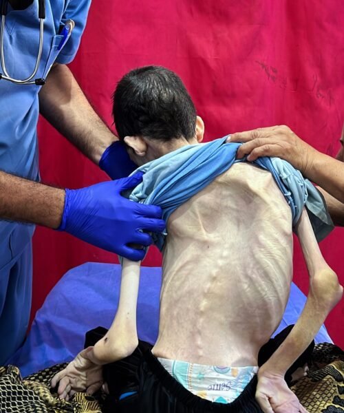 Hospitales catalanes atienden a seis menores enfermos provenientes de Gaza