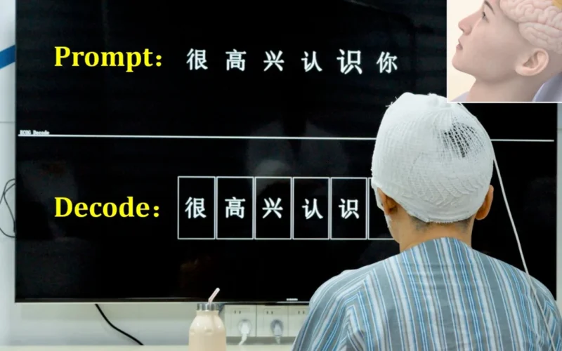 Esta es la respuesta china al implante Neuralink de Elon Musk