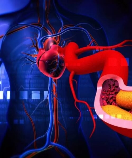 Superar el límite de colesterol implica más infartos y muertes: «Cuando pone 100 es como una señal de tráfico, no hay que sobrepasarlo»