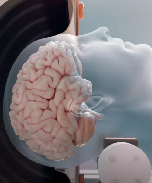 Tratar el cáncer y el Alzheimer con ultrasonidos