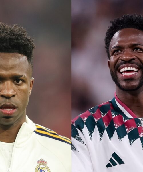 La nueva imagen de Vinicius: «Es el tratamiento que se hacen los hombres cuando quieren lucir más potentes desde la masculinidad»